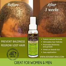 Load image into Gallery viewer, Hair Growth Booster (For Thinning or Balding Hair)